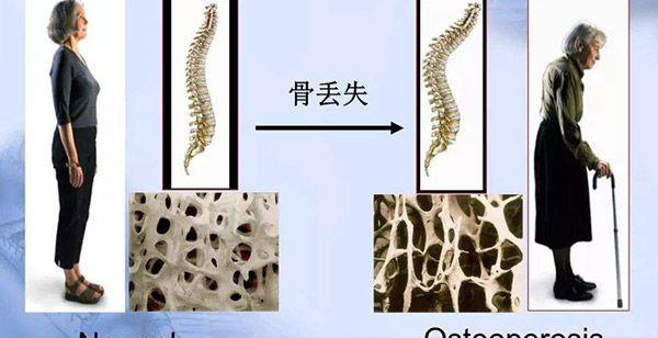 打曲普瑞林5天破卵?网友谈经验,需看这一方面