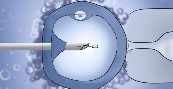 精子畸形、dna碎片率高，三代试管婴儿或许是最后“救星”