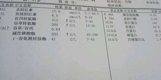 谷草转氨酶44算高吗?我们可根据其正常值范围加以判断
