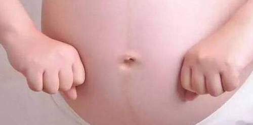 为什么会有妊娠线?妊娠线形成的原因分析