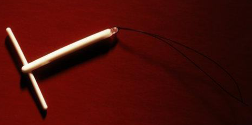 据说并不贵!5种不同种类节育环的价格一览