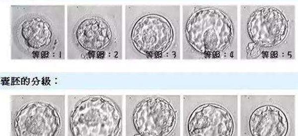胚胎养囊报告单上的等级怎么看？