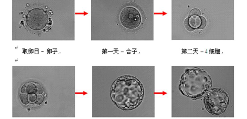 试管婴儿中囊胚3bb和4bb的区别有哪些？