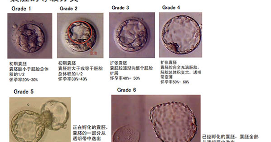 2CC囊胚成功率是不是很低？
