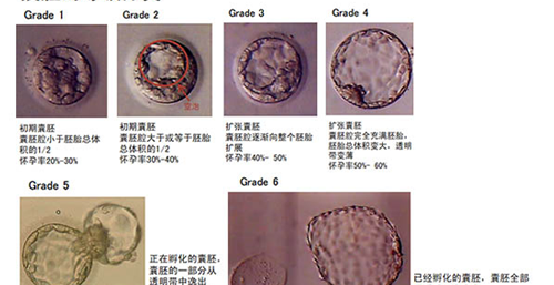 试管囊胚d5天与d6天哪个好？你们想知道的区别在这里