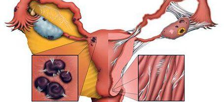 子宫内膜正常厚度