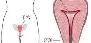 子宫内膜薄怎么办？会影响怀孕吗？