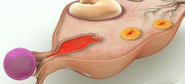 子宫内膜薄，试管婴儿移植前这么调理更有效！