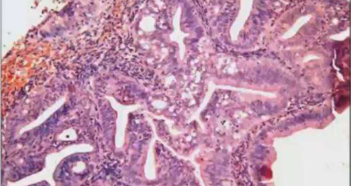 健康饮食调理,是子宫内膜薄增加方式之一