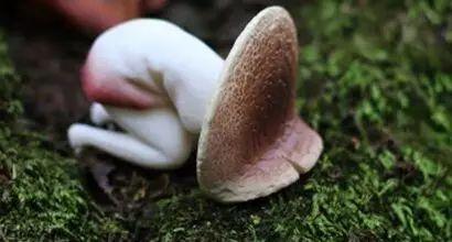 痛经？警惕试管婴儿拦路虎-子宫内膜异位症！