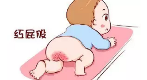 男宝宝尿布疹图片是什么样子？