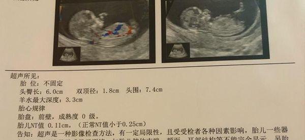 准确率90的nt单看男女是怎么看的？