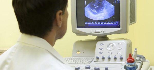 NT显示胎头在左边是男孩还是女孩？