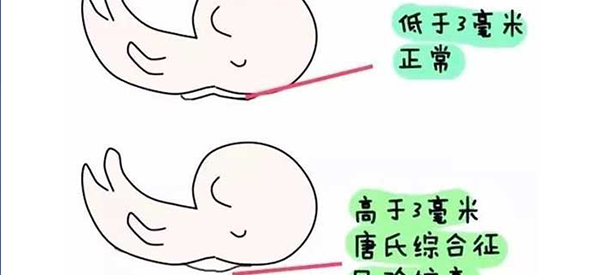 成都妇幼保健院nt都是免费做的吗？