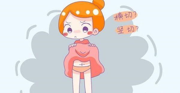 剖腹产选横切还是竖切学问多，这4大区别先分清楚