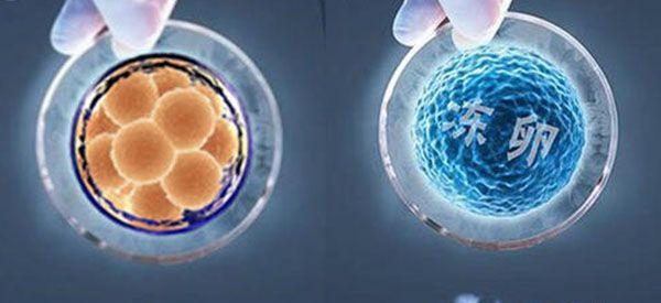 做试管时取卵和取精应该哪个先进行？
