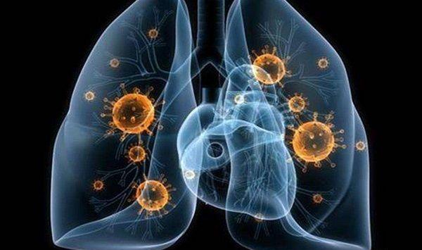 婴儿呛奶多久得肺炎不一定，这8个早期症状可助你判断