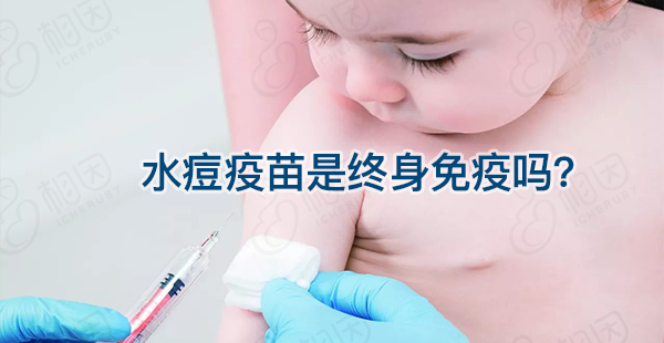 宝宝接种水痘疫苗能维持多久时间？一到两次或可终身免疫