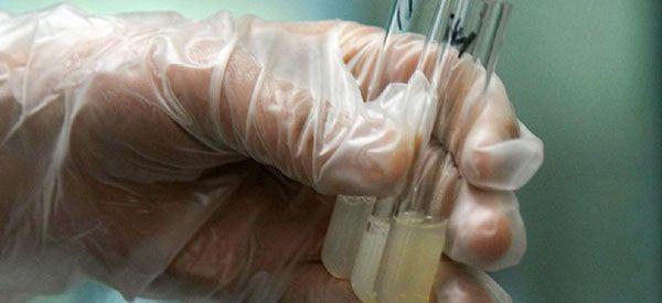 做二代试管婴儿，男方应该提前多久排精一次？