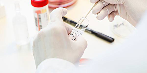 比试管婴儿便宜多了!2022年人工授精费用明细分享