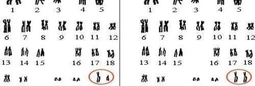 男女双方保证染色体正常很重要，缺失、单体严重无法生育