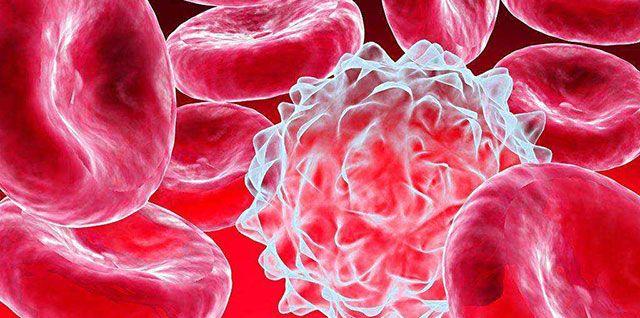 5q-综合征(5号染色体长臂缺失综合症)会影响孩子智力吗