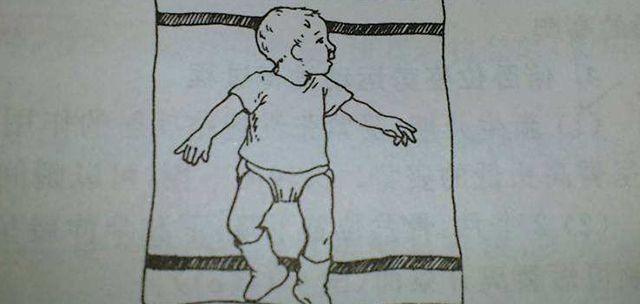 2号染色体2q37缺失综合征有什么表现，是如何遗传？