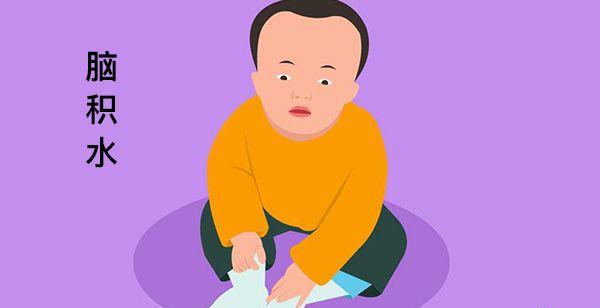 9号染色体q22.3微缺失的孩子或出现脑积水症状