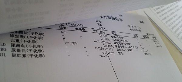 尿糖阳性不一定是糖尿病，浅谈其形成的4大原因