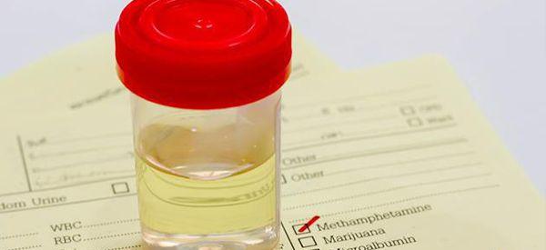 试管移植后第十天孕试纸验孕不用晨尿会影响结果吗？