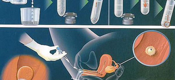 西安唐都医院做试管婴儿需要多长时间？