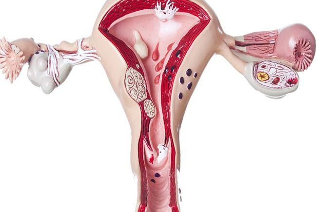 无子宫女性怎么怀孩子，通过IVF技术能怀吗？