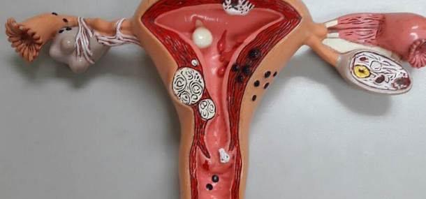 100%干货！输卵管不通先治疗还是直接做试管婴儿？