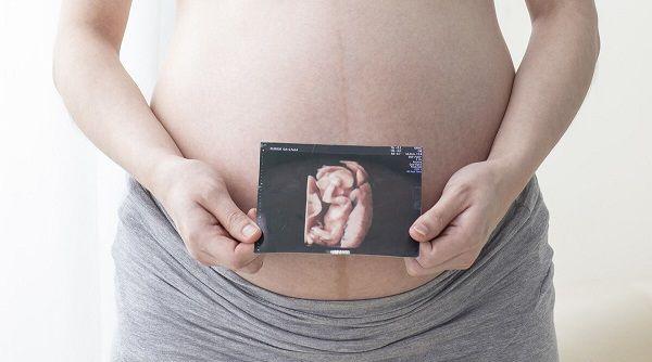 武汉四维彩超费用表整理，内附市妇保院超全预约攻略