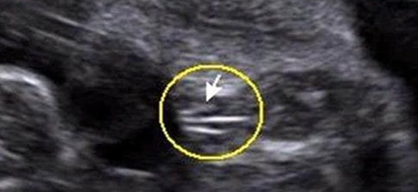 女宝的四维彩超图有哪些特点？