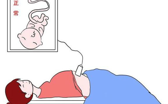 完成大排畸所有检查项目需要多少钱？