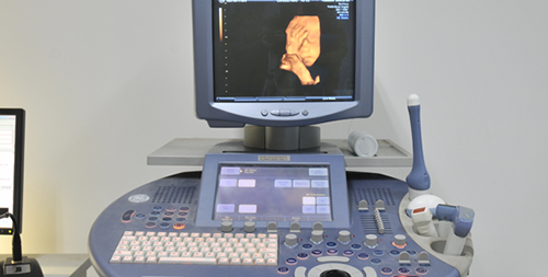 判断生男女小窍门!四维彩超看胎儿性别方法分享