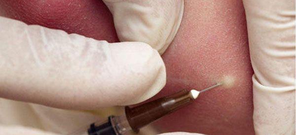 中国哪年开始强制推行新生儿必须接种卡介苗的？