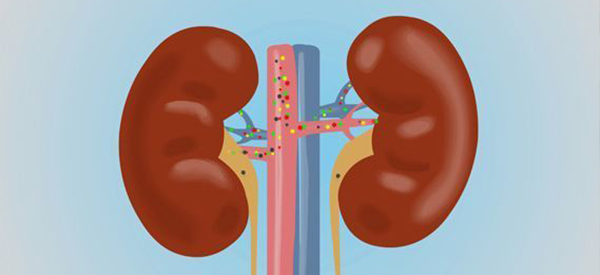体检肌酐值为123严不严重？