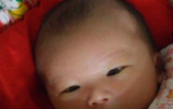 唐氏患儿出生后一般多久开始吐舌头？