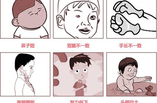 轻度唐氏儿智商能达到几岁？