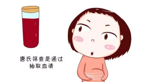 唐氏筛查过程并不复杂，夫妻俩人一起去更省心