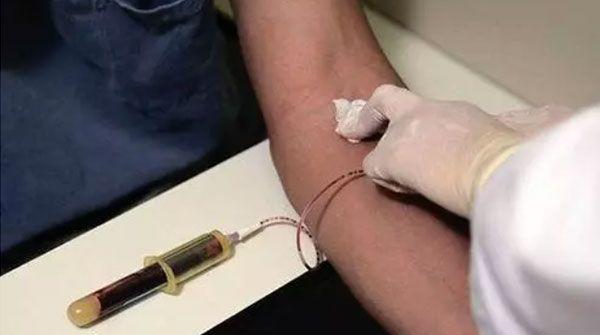 唐氏筛查低风险时不要慌，确定唐氏儿还得做无创