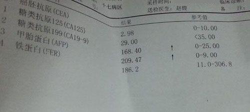 首次检查糖类抗原125偏高别担心搞清原因很重要