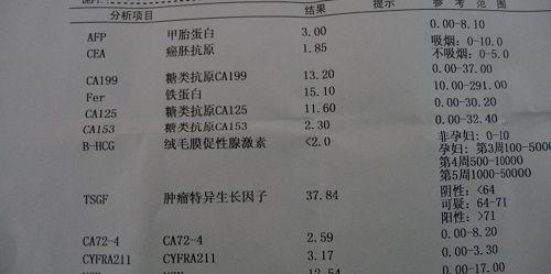 糖类抗原125检测需注意结果为56.7时可能是肿瘤