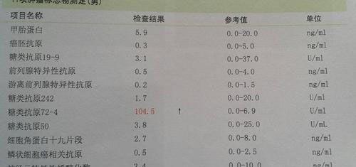 糖类抗原ca125偏高别担心多吃少糖蔬菜就可治疗