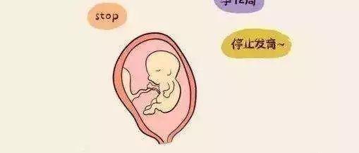 为什么自然受孕三次后三次都胎停了？