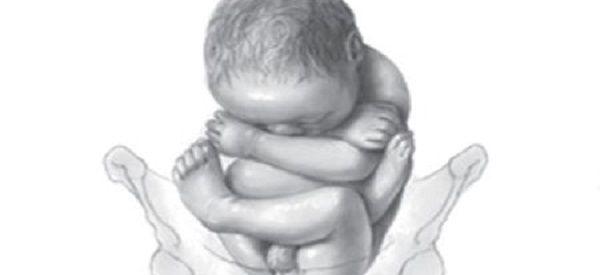 四维彩超检查下臀位是男孩多还是女孩多？