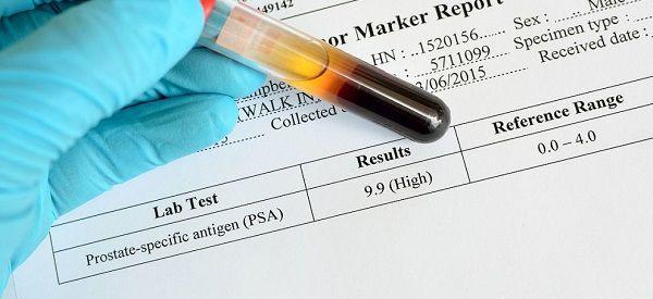 无创DNA绝对值得出的看男女公式怎么看的