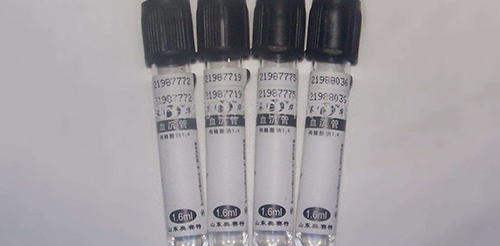 血沉低会引发什么疾病?来看看相关医生有什么看法